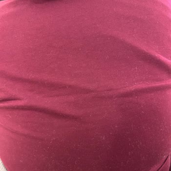 Teslimat Gecikmesi Ve Kırılgan Kumaş Nedeniyle Alerji Sorunu