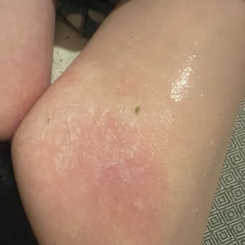 Trendyol Layrol Ürün Şikayeti