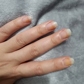 Flormar Pl068 Ojesi Tırnaklarda Turuncu Lekeler Oluşturdu