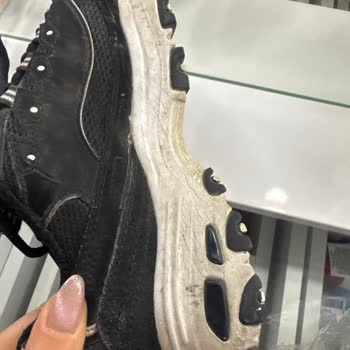 Kısa Sürede Bozulan Skechers Ayakkabısı Ve Çözüm Reddi