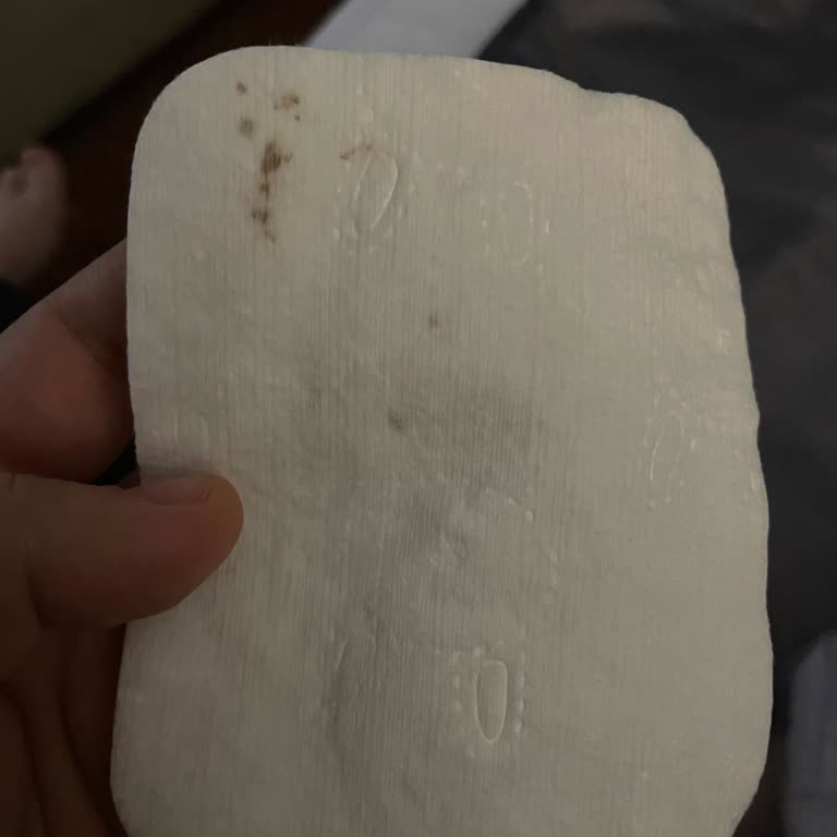 Kir Lekeli Bebek Pamuğu Şikayeti: Hijyen Ve Güven Endişesi