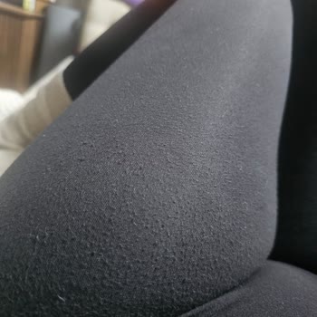 Sezgi Tekin İki Kez Giyilen Taytta Aşırı Tüylenme Ve Deformasyon: İade Talebi