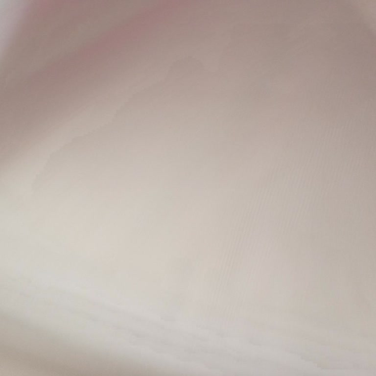 Garanti Kapsamındaki Çökme Sorunu İhmal Edilen Ve İade Süreci Karışık Kilim Mobilya