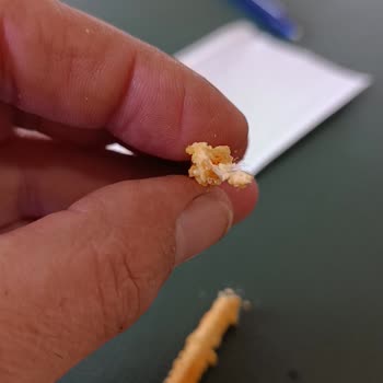 Eti Crax Patlayan Lezzet Krakerinde Yabancı Madde Ve Sağlık Riski