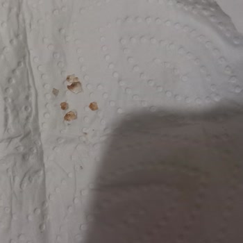 Dr. Oetker Muffin Karışımında Cam Parçası Bulundu