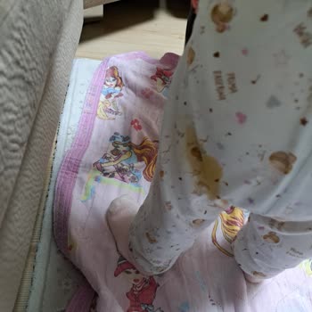 Bebek Bezinde Sızıntı Sorunu İade Ve Değişim Talebi