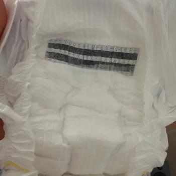 Molfix 5 Numaralı Bez Şikayeti İçin Geri Dönüş Talebi