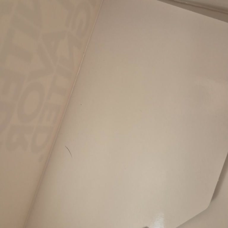 Hijyen Sorunu: Yemekte Kıl Ve İade Reddi