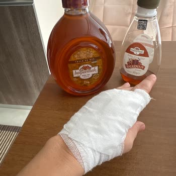 Balparmak Çıt Kapaklı Bal Kapağını Açarken Elime Kesik Geldi - Güvenlik İhlali