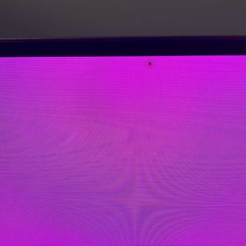 Garanti Süresi Sonrası Panelde Ölü Piksel Sorunu Ve LG’nin Ücretsiz Servis Reddi