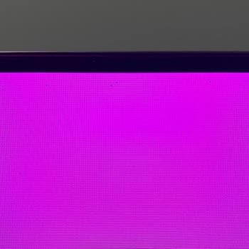 Garanti Süresi Sonrası Panelde Ölü Piksel Sorunu Ve LG’nin Ücretsiz Servis Reddi