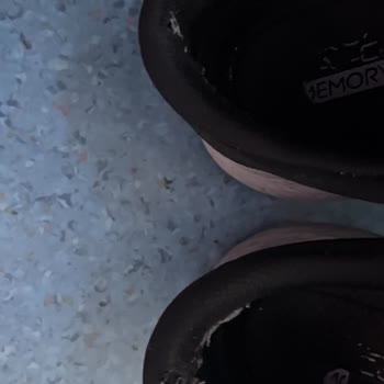 Skechers Ayakkabısında Kısa Sürede Deformasyon Ve Değişim Talebi