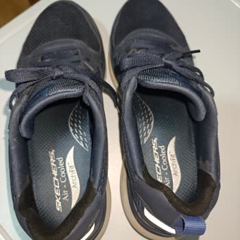 Skechers Ayakkabılarda 35 Gün İçinde Arka Kısım Delindi Ve Destek Sorunu