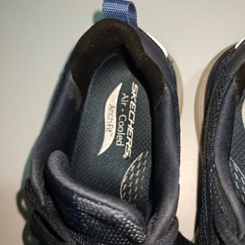 Skechers Ayakkabılarda 35 Gün İçinde Arka Kısım Delindi Ve Destek Sorunu