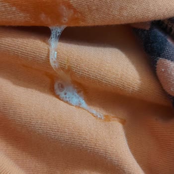 Milupa Aptamil 1 Pronutra Mamadan Sonra Bebeğimde Şiddetli Kusma Ve İshal