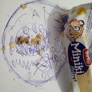 Torku Miniki Ürününde Sert Madde Bulunması Ve Diş Kırılması