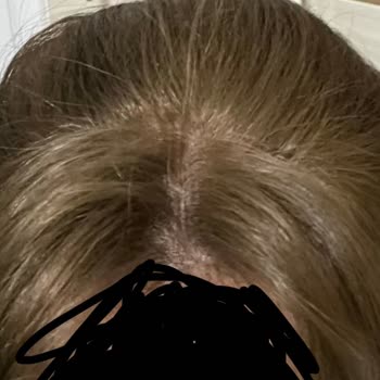 Helo Kuaför (Ankara) Fiyat Farkı Ve Kalitesiz Saç İşlemi Nedeniyle İade Talebi