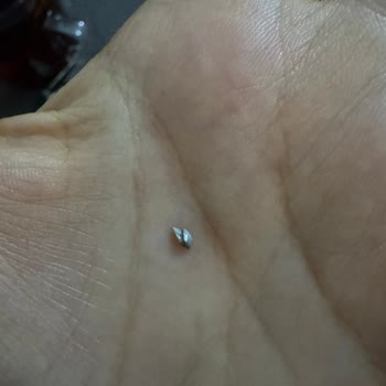 Ülker Mini Kekte Metal Parça Güvenimi Sarsıyor