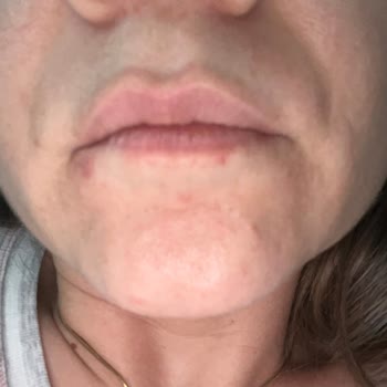 Mac Studio Fix Fondöteni Cildi Mahvetti, 1600 TL İadesi Talebi