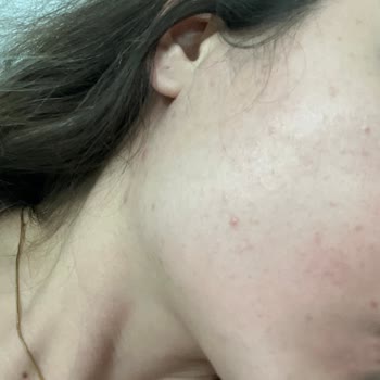 Mac Studio Fix Fondöteni Cildi Mahvetti, 1600 TL İadesi Talebi