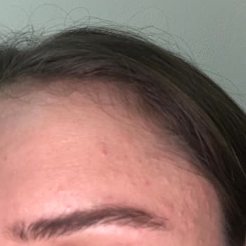 Mac Studio Fix Fondöteni Cildi Mahvetti, 1600 TL İadesi Talebi