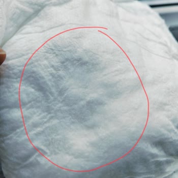 Baby Turco 4 Numara Bezde Sağlıksız Ve Kusurlu Ürün, İade Talebim Dikkate Alınmadı