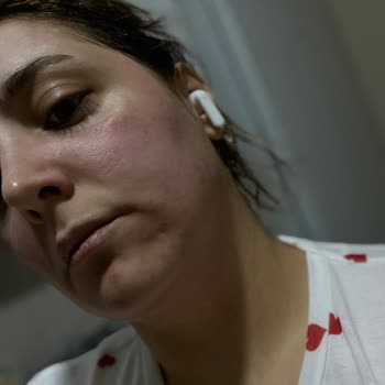 Nivea Care Canlandırıcı Yüz Temizleme Jelinde Ani Yanma Ve Şişme Şikayeti