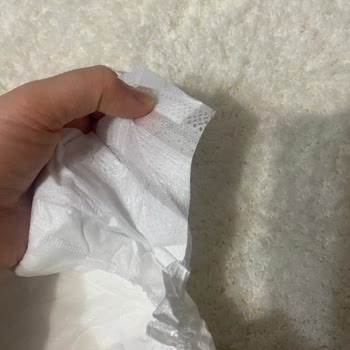 Sleepy Bebek Bezlerinde Çıtçıt Yapışkan Sorunu Ve Kalite Kontrol Eksikliği