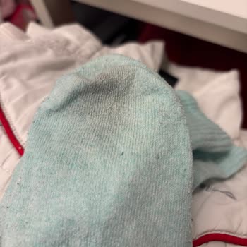 Electrolux Çamaşır Makinesi Lekeleri Çıkarmıyor Ve Su Alımı Yetersiz