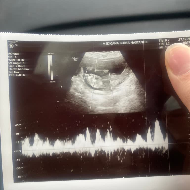 Medicana Sağlık Grubu Bursa Hastanesinde Ultrason Görüntülerinin Verilmemesi