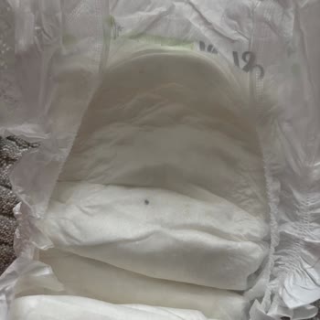 Sleepy Bezinde Siyah Lekeye Şikayet