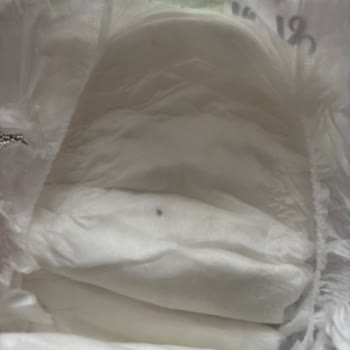 Sleepy Bezinde Siyah Lekeye Şikayet