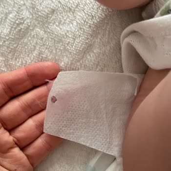 Molfix Bebek Bezlerinde Çıtçıt Eksikliği!