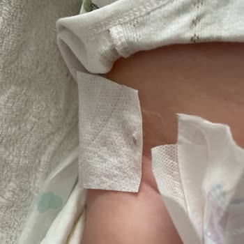 Molfix Bebek Bezlerinde Çıtçıt Eksikliği!