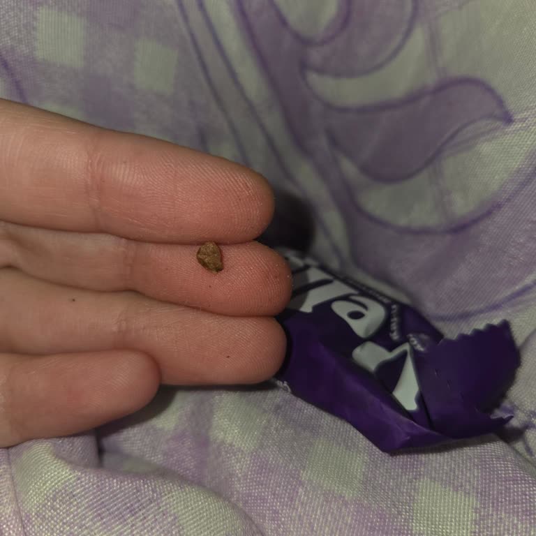 Protein Bar İçinde Taş Parçası: Sağlık Riski