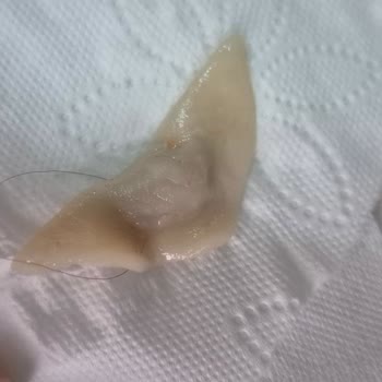 Ekmecik Hazır Kıymalı Mantıda Saç Bulunması Ve İade Talebi