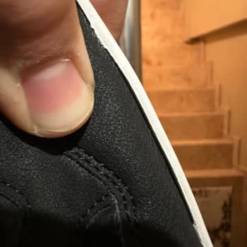 Yan Taraf Açılmaları Ve Su Girişi İçin Garanti Reddine Karşı Şikayet