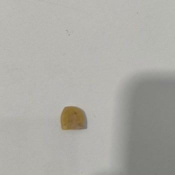 Torku Çıtır Gofretinin İçinde Sert Plastik Parça Dişi Ağrıttı