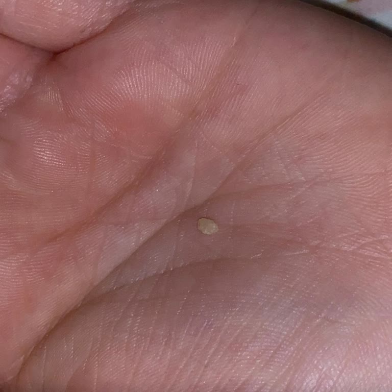 Kent Şekerleme Sour Patch Kids Jelibonunda Taş Çıktı, Dişim Kırıldı