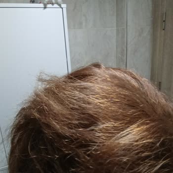 Schwarzkopf Saç Derimde Yanık Ve Aşırı Dökülme Yaşadım