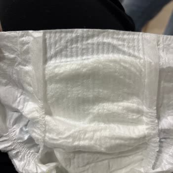 Migros’tan Alınan Molfix Bebek Bezinde Bel Lastiği Eksikliği Ve Sürekli Sızdırma Sorunu