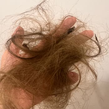 Saç Şekillendirme Setinde Yanma Sorunu Ve İade Reddi