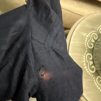 Ramsey Takım Elbisesinde Kısa Sürede Bacak Arası Yırtılması!