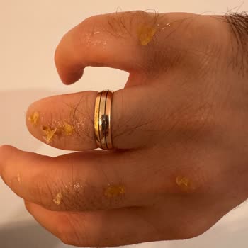 Cips Paketi İçindeki Aşırı Sıvı Yağ Çocuğumun Eli Bulaştı