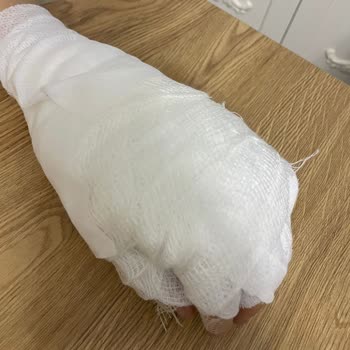 Neva Çaydanlık Setinde Sap Kopması Nedeniyle Ciddi Yanık Ve Güvenlik Sorunu