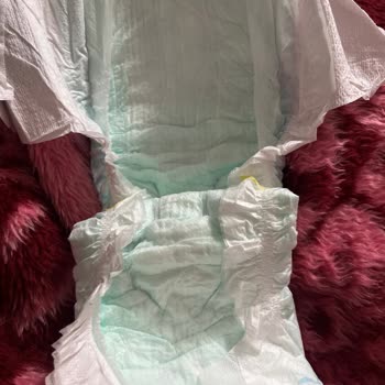 Molfix Bezlerde Yeşil İç Renk Ve Şiddetli Pişik Şikayeti