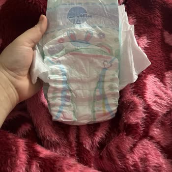 Molfix Bezlerde Yeşil İç Renk Ve Şiddetli Pişik Şikayeti