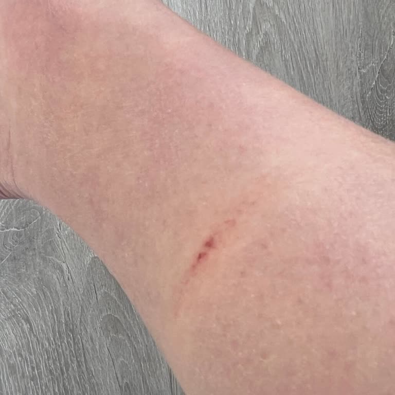 Calvin Klein Botunun Kesici Kenarı Sağlık Riskine Yol Açtı, İade Gerekiyor