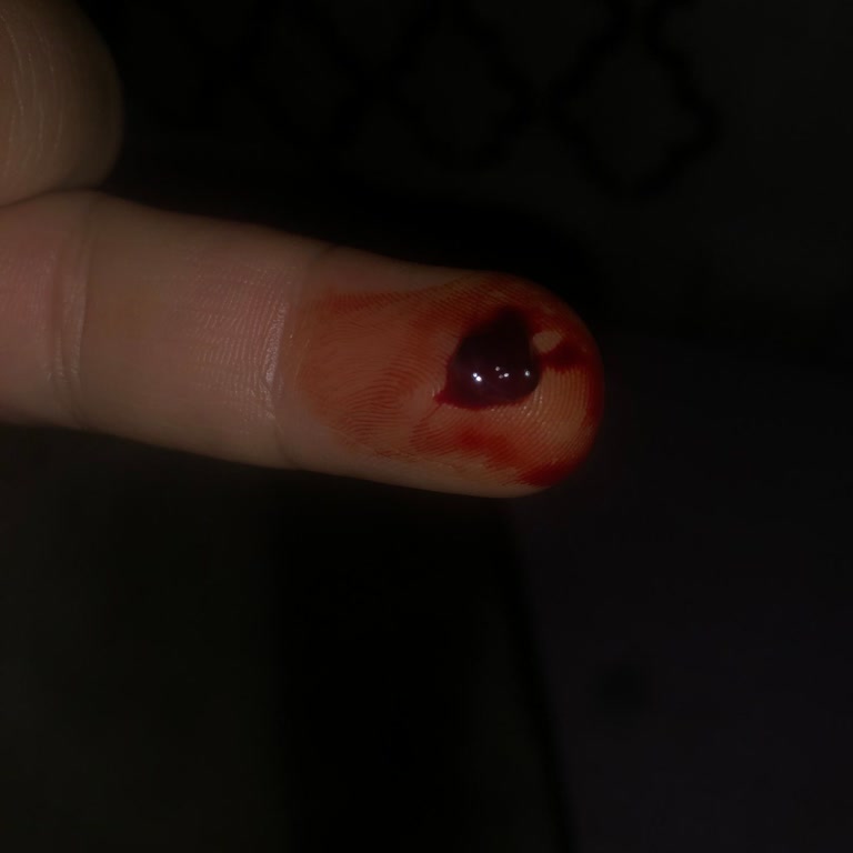 Fatma Kemal Timuçin Diş Hastanesi Yaşadıklarım Hem Sağlığımı Hem De Psikolojimi Olumsuz Etkiledi