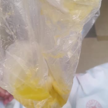 Annemin Şiddetli Belirtileri İçin Uygun Servis Değişikliği Ve Taburcu Kararının Gözden Geçirilmesi